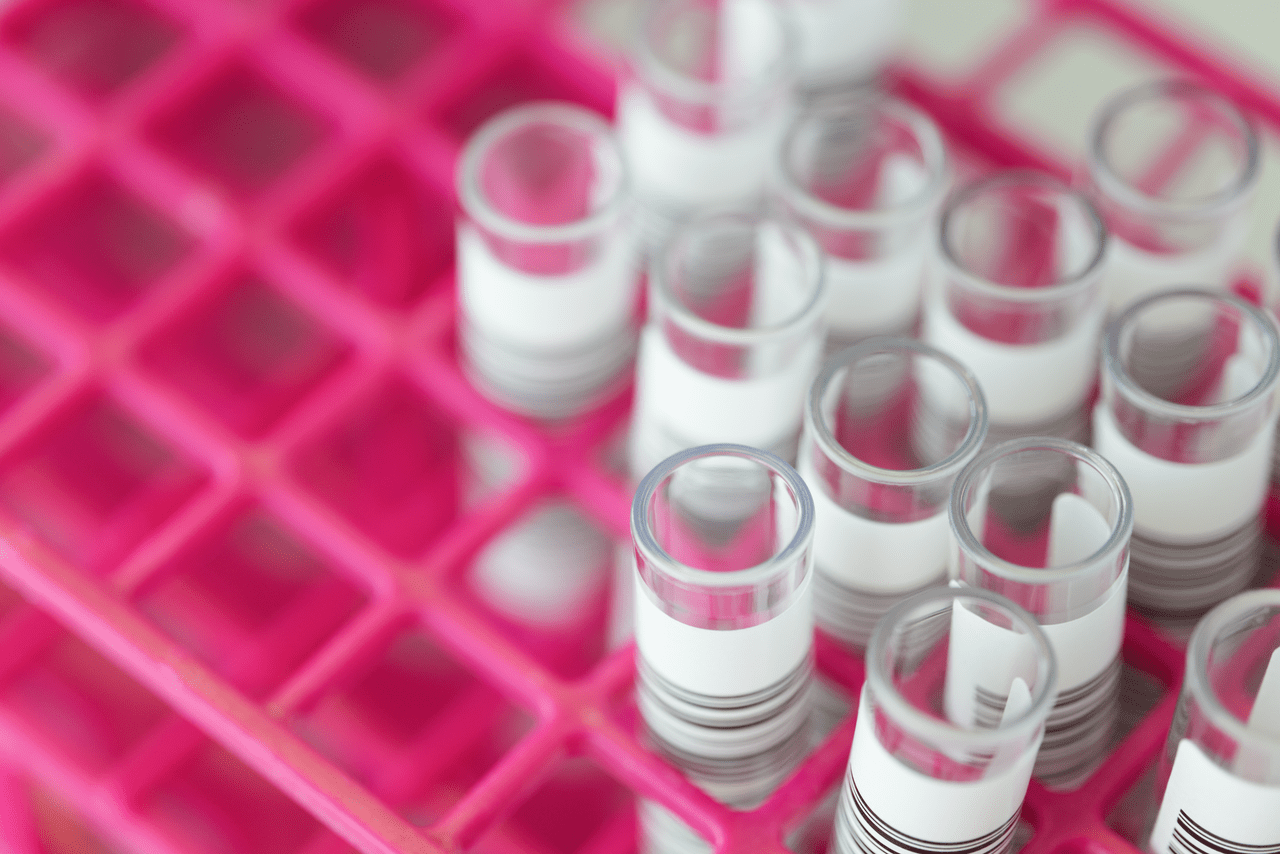 Transforming Diagnostic Access: A Roadmap for ASEAN