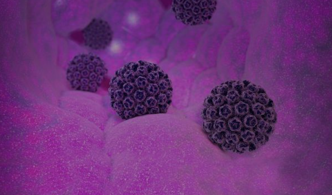 Translating Cervical Cancer Research into ActionGetting Personal with Healthcare