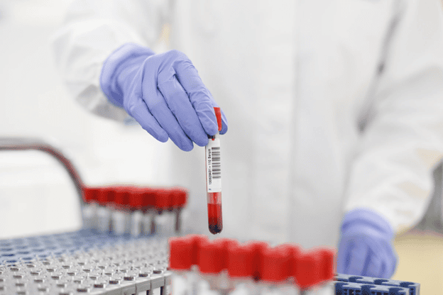 How Nucleic Acid Testing can prevent blood infections — and save lives