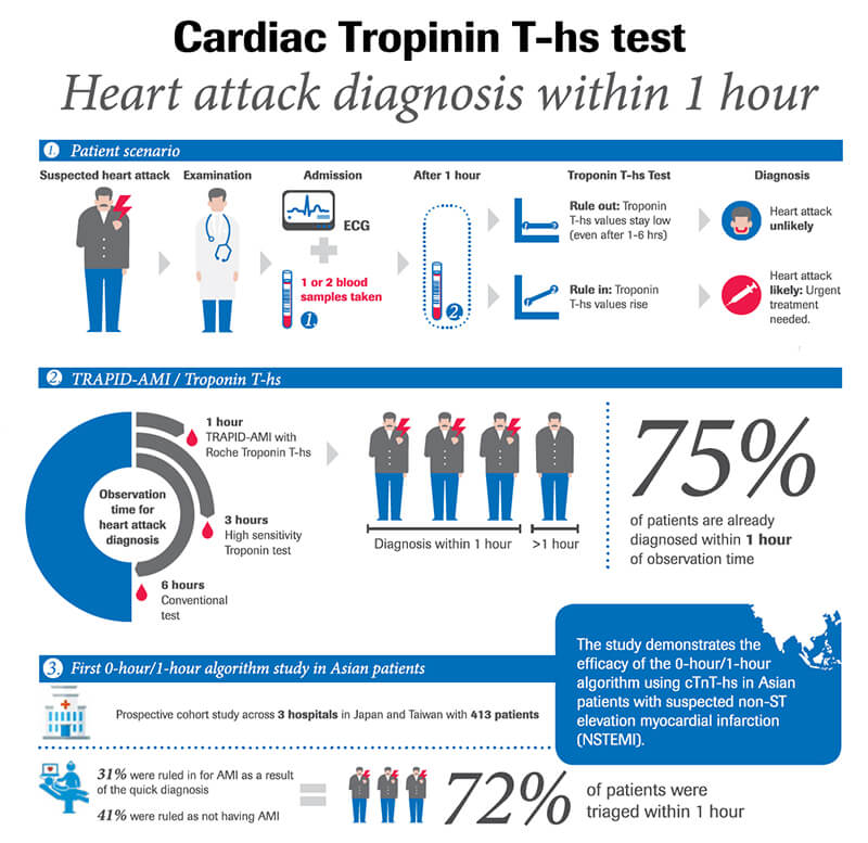 Cardiac Troponin T high sensitivity test